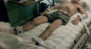 shackled patient